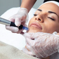 Microneedling Facial o Corporal