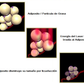 Lipolaser